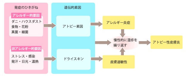 アトピー発生のメカニズム
